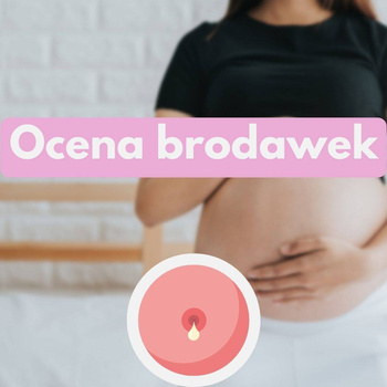 Konsultacja oceny brodawek